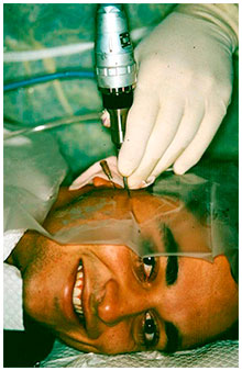 TMJ Surgery
