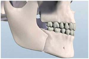 before anesthesia