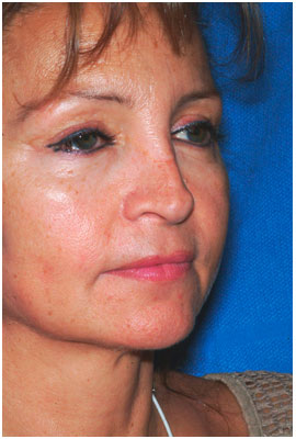 before anesthesia dr. diaz