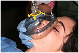 Anesthesia - Temporomandibular joint disorders (TMD)