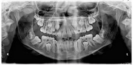 Surgical-orthodontics